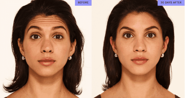 botox at dr bailey medpsa in Leeds